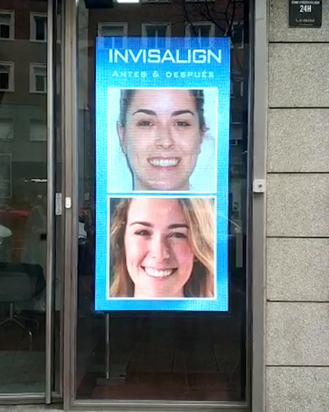 Pantalla de led vertical detrás de un escaparate. En la pantalla se reproducen una publicidad haciendo referencia al tratamiento de invisalign.